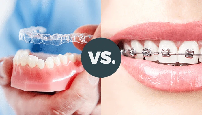 Orthodontics (Braces, Aligners)​
